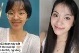 Màn thay đổi "đáng đồng tiền" của cô gái TP.HCM sau khi từ bỏ ăn thô, niềng răng và mổ mắt cận