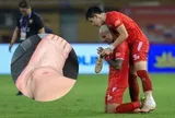 Đình Bắc lộ ảnh cổ chân sưng biến dạng sau trận vô địch V.League cùng CLB CAHN