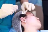 Trào lưu tự căng da mặt tại nhà gây sốc: Nhiều cô gái đối mặt nguy cơ hủy hoại gương mặt