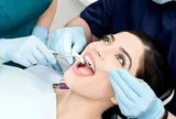 Đi nhổ răng có được bảo hiểm y tế chi trả?