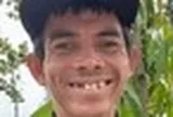 Tình trạng chàng trai chăn bò từng nổi tiếng toàn cầu