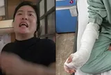 Bị khách "bùng" tiền 30 bánh chưng, chém nhập viện: Tình trạng sức khỏe của chủ quán