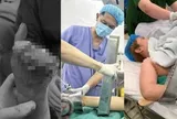 Cảnh báo bất cứ ai đang dùng máy xay thịt