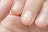 Ung thư có thể được phát hiện qua bàn tay? Bác sĩ cảnh báo: Xuất hiệu 5 dấu hiệu này, đừng nên chủ quan