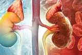 1 thói quen buổi tối có thể khiến thận xuống cấp nhanh chóng: Gặp ở rất nhiều người Việt
