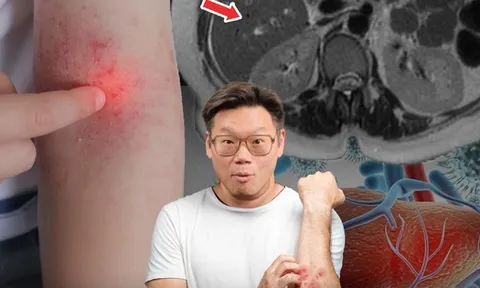 Phó Giám đốc Bệnh viện Thái Lan cảnh báo 4 dấu hiệu trên da là "lời kêu cứu" của gan, nhiều người bỏ qua rồi hối hận không kịp
