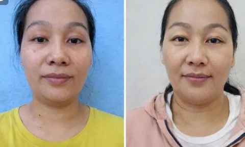 Truy nã toàn quốc người phụ nữ lừa đảo các cơ sở dịch vụ cưới