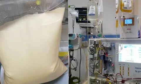 25 tuổi, máu chuyển trắng như sữa, cùng lúc mắc 3 bệnh nguy kịch: Bác sĩ cảnh báo lối sống này đang âm thầm “bôi mỡ” vào máu người trẻ