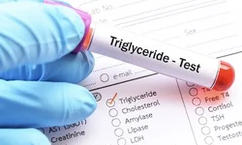 Người đàn ông U40 máu trắng đục như sữa, bác sĩ chỉ đích danh sai lầm khiến mỡ máu tăng vọt