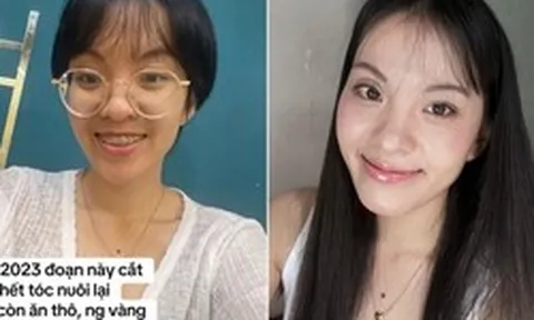 Màn thay đổi "đáng đồng tiền" của cô gái TP.HCM sau khi từ bỏ ăn thô, niềng răng và mổ mắt cận