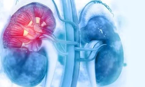 2 quả thận bị "bóp nghẹt", "xuống cấp" nhanh hơn chỉ vì 5 thói quen gặp ở nhiều người Việt