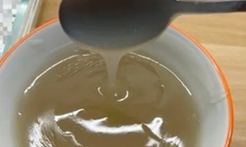 Thiếu nữ 16 tuổi qua đời vì suy thận, người mẹ tiết lộ bí mật liên quan đến điều gần như cô gái nào cũng "ám ảnh"