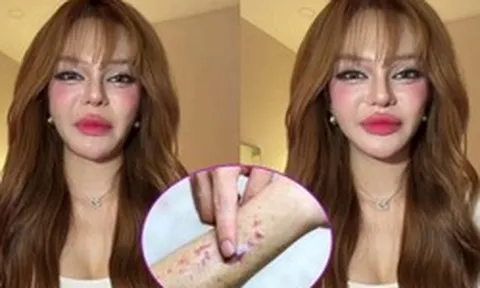 Video lúc nửa đêm của TikToker 11 triệu người theo dõi khiến nhiều người giật mình: Ung thư máu có đến từ thói quen thức khuya, uống trà sữa?