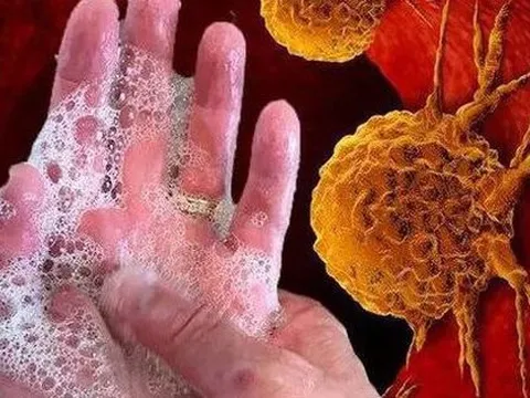 Vệ sinh kém, có thể phải đối mặt với 2 bệnh ung thư