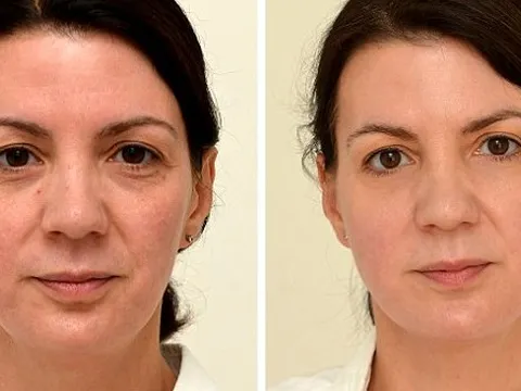 Thử nghiệm uống đủ lượng nước này trong 4 tuần, người phụ nữ 4x trẻ ra 10 tuổi