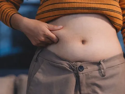 Sợ Tết tăng liền 2kg? Bác sĩ bật mí cách “chuẩn bị trước” để sau Tết vẫn tăng cơ, giảm mỡ