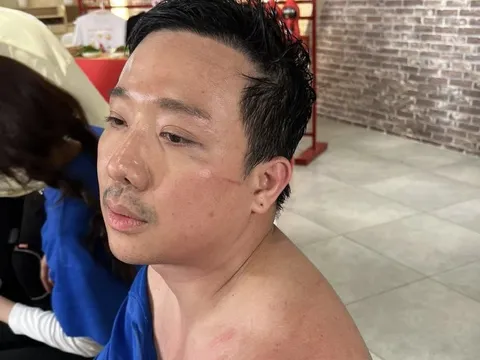 Sao Trấn Thành đến nông nỗi này?