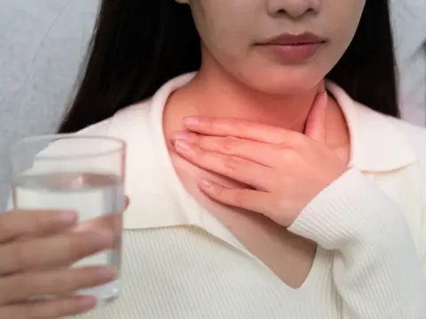 Đau họng kéo dài vì đâu?