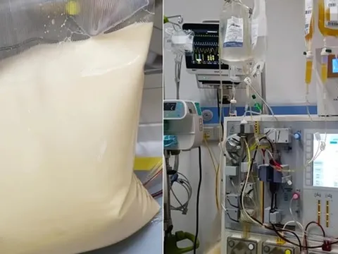 25 tuổi, máu chuyển trắng như sữa, cùng lúc mắc 3 bệnh nguy kịch: Bác sĩ cảnh báo lối sống này đang âm thầm “bôi mỡ” vào máu người trẻ