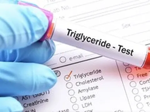 Người đàn ông U40 máu trắng đục như sữa, bác sĩ chỉ đích danh sai lầm khiến mỡ máu tăng vọt