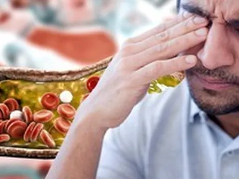 Nhìn vào mặt cũng có thể biết mỡ máu cao hay không: Nếu thấy 2 dấu hiệu này, hãy đi khám ngay