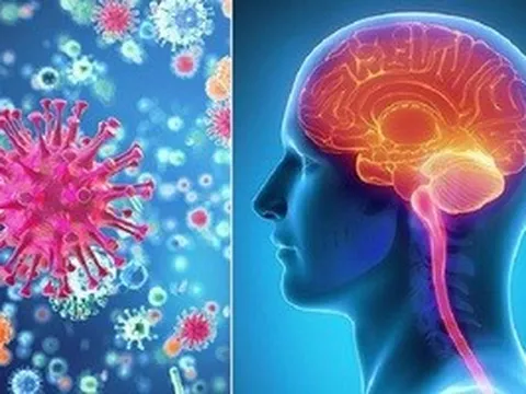 Kết quả xét nghiệm 3 trường hợp nghi viêm não mô cầu ở Cà Mau