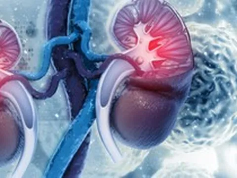 Thận xuống cấp nhanh chóng nếu ăn quá nhiều 9 loại thực phẩm này: Toàn món khoái khẩu của nhiều người