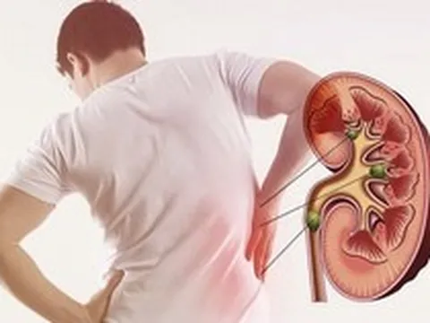 Cảnh báo: Dấu hiệu đầu tiên khi SUY THẬN, chỉ cần uống nước là có thể phát hiện ra?