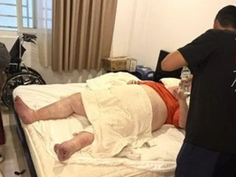 Du khách nặng gần 300 kg mắc kẹt trong nhà vệ sinh ở Đà Nẵng