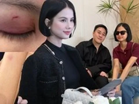 Động thái mới của nữ bác sĩ sau khi Trung Quân idol gặp mặt xin lỗi