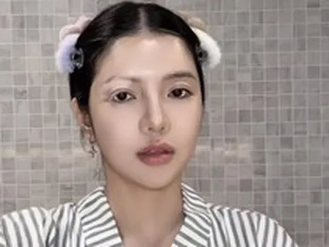 Mỹ nhân Việt mắc bệnh hiếm chỉ 2% dân số thế giới gặp phải