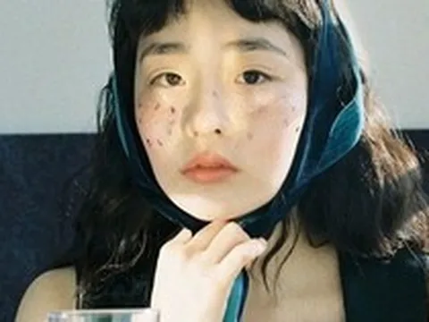 Các bác sĩ khuyên: Không cần chờ tới lúc ngứa da, thấy 7 dấu hiệu này trên mặt tức là máu đã "ngập đường"