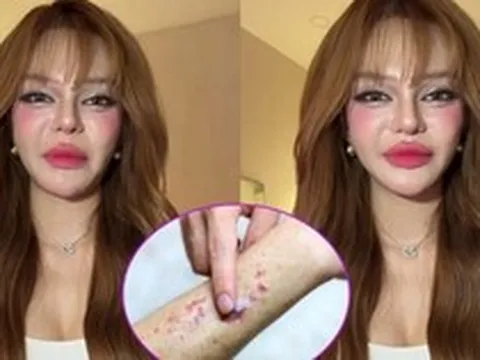Video lúc nửa đêm của TikToker 11 triệu người theo dõi khiến nhiều người giật mình: Ung thư máu có đến từ thói quen thức khuya, uống trà sữa?