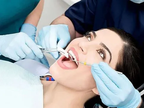 Đi nhổ răng có được bảo hiểm y tế chi trả?
