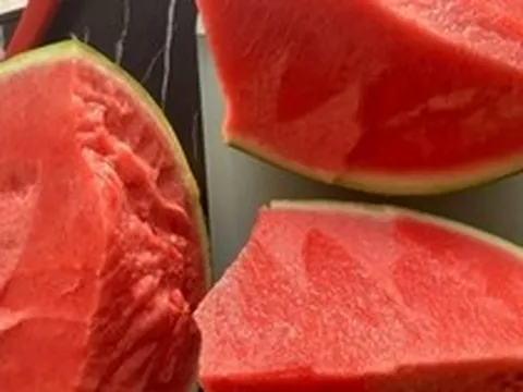 Cụ ông phổi trắng xóa, thận "ngừng hoạt động" sau khi ăn dưa hấu giải nhiệt