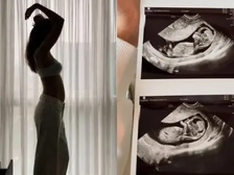 Rầm rộ tin 1 nàng hậu đang mang thai 5 tháng bị “cắm sừng”, bạn trai doanh nhân trơ mặt cặp kè chân dài ai cũng biết