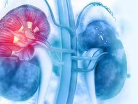 Khi thận suy hỏng, cơ thể sẽ đau ở 1 chỗ: Tiếc là nhiều người bỏ qua