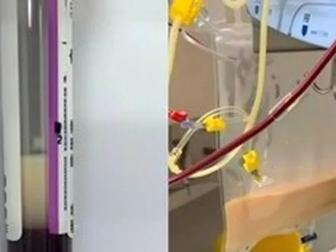 Người phụ nữ ngoài 30 tuổi máu trắng như sữa sau khi uống 4 cốc nước "vạn người mê" trong 1 ngày