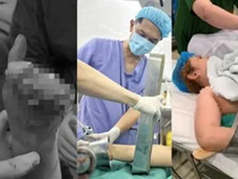 Cảnh báo bất cứ ai đang dùng máy xay thịt