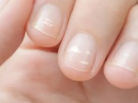 Ung thư có thể được phát hiện qua bàn tay? Bác sĩ cảnh báo: Xuất hiệu 5 dấu hiệu này, đừng nên chủ quan